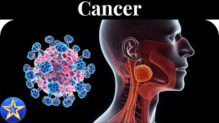 Cancer Causes Diagnosis and Treatment [upl. by Palermo]