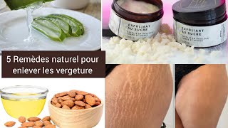 5 Remèdes naturel pour enlever la vergeture sur votre corps [upl. by Mandel943]