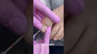 Pedicure transformation with Xcoat tips ✌️BTArtboxNails [upl. by Ahtreb306]