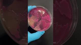 Acinetobacter baumannii is pretty 😊 [upl. by Viki945]