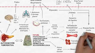 Fisiopatología de la pancreatitis aguda en 6 minutos [upl. by Gosney]