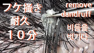 No172 たっぷり１０分フケはがし  10 minutes of dandruff removal  10 minutos para eliminar la caspa  10分鐘去頭皮屑 [upl. by Ayrolg]