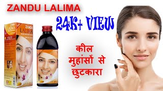 Zandu lalima syrup review in hindi use and Benifits [upl. by Charlet]