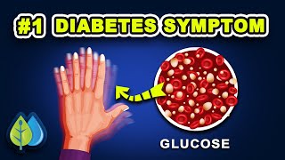 Early Signs of Diabetes  1 Type 2 Diabetes Symptoms People Ignore [upl. by Yeliak949]