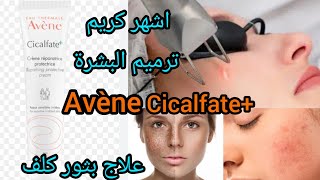 Avène cicalfate مميزات طريقة استعماله للبثور والكلف ترميم البشرة [upl. by Arabelle]