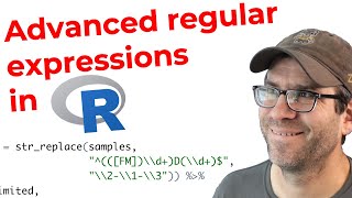 Creating an advanced regular expression in R with strreplace and separate CC184 [upl. by Acimaj]