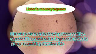 Listeria monocytogenes under microscope [upl. by Ardnod291]