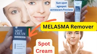 MELASMA Remover spot cream Review ✅ priceused cautionMoizabeauty [upl. by Ytsirhc]