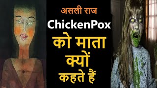 Chickenpox बीमारी को माता क्यों कहते हैं  क्या है असली राज [upl. by England]