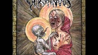 VERMINOUS  Impious Genocide 2003 [upl. by Caesaria]