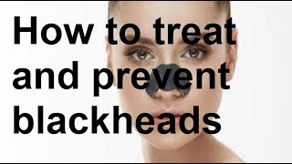 How to treat and prevent blackheads [upl. by Nitnilc230]