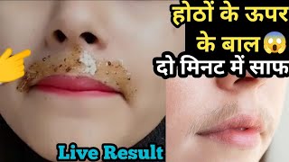 इस चीज से होठों के ऊपर के बाल ऐसे हट गए😱 2 मिनट में मैं तो हैरान हू🤔 upper lip hair removal [upl. by Esorylime492]