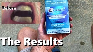 CREST Whitening Strips 3D BeforeAfter 12 Treatments Vivid Plus Teeth Enamel Cleaning 30 minutes [upl. by Einahteb]