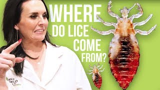 7 Horrible Truths About Lice [upl. by Dutchman]