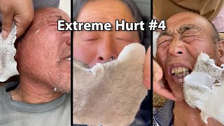 OMG Extremely Hurt Beard Waxing Remover You Can Try Easy [upl. by Nevsa220]