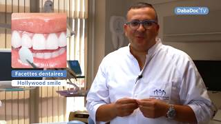 Dr Mohamed Tajmouati hollywood smile facettes dentaires [upl. by Uhsoj]