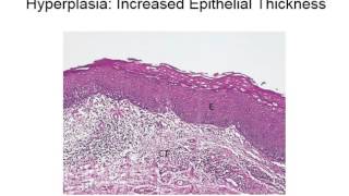 Inflammation and Repair  Oral Pathology Ch 2 Lecture 2 [upl. by Cates]