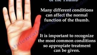 Common Conditions Of The Thumb  Everything You Need To Know  Dr Nabil Ebraheim [upl. by Green]