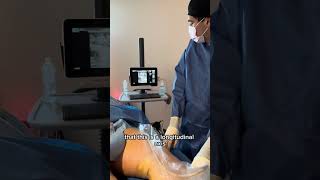 Lipedema Reduction Surgery on patients Calves with Dr Wright lipedema [upl. by Llenrep256]