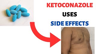 KETOCONAZOLE NIZORAL Uses Side effects Review Shampoo Cream Soap Lotion [upl. by Yenaj]