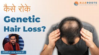 Genetic Hair Loss को कैसे रोके  How to control Genetic Hair Loss  Explained by Dr Alok Sahoo [upl. by Eolanda895]