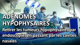 Adénomes hypophysaires  retirer les tumeurs hypophysaires en passant par les cavités nasales [upl. by Anovahs215]