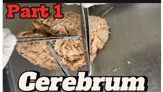 Gyri and sulci of cerebrum part 1 mbbsanatomy nepalforyou viral medicalhacks [upl. by Seavir]