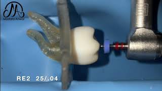 RACE EVO Rotary System for Management of Multiplanar Root Canal Curvatures Educational Demo Video [upl. by Wanda]