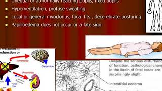 acute fulminant hepatic failure fhf [upl. by Irroc231]