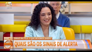 Sinais na pele o que devemos saber  Programa Manhã CM da CMTV [upl. by Ygief]