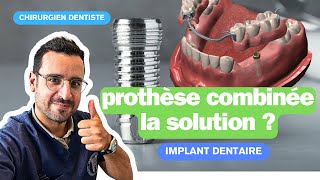 Dents mobiles  les implants dentaire pour stabiliser un appareil [upl. by Browne]