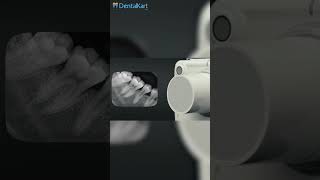 Benefits of handheld dental XRay Machine [upl. by Gerrald]