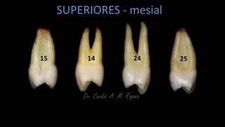 Anatomia PréMolares [upl. by Nylrac]