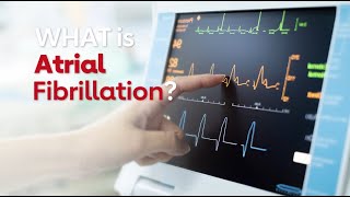 What is Atrial Fibrillation [upl. by Phelgon23]