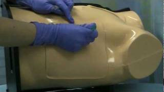 Chest Tube Placement Tulane Medicine [upl. by Cyrie111]