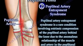 Anatomy Of The Popliteal Fossa  Everything You Need To Know  Dr Nabil Ebraheim [upl. by Saunder]