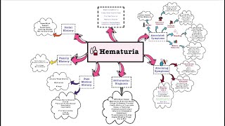 Hematuria  OSCE [upl. by Htiderem]