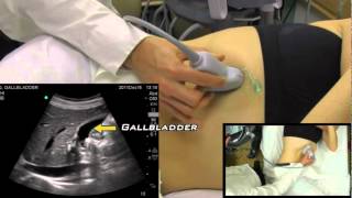 Gallbladder Ultrasound from One Minute Ultrasound [upl. by Randall]