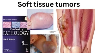 chap 29 Soft tissue tumorsHarsh Mohan pathology quick review complete chapter [upl. by Politi95]