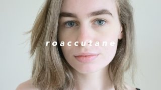 My COMPLETE Roaccutane Experience  Katie Joslin [upl. by Ettennyl301]