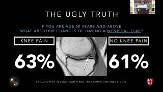 Webinar 7 S10 100 Highly S1R selective PETMR imaging for localizing and managing pain treatment [upl. by Starobin639]