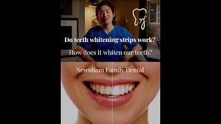 Do teeth whitening strips work [upl. by Leroy499]