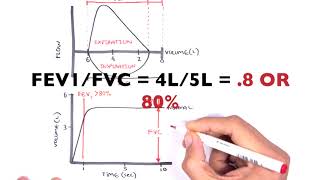 Understanding Spirometry  Normal Obstructive vs Restrictive [upl. by Ecilayram]