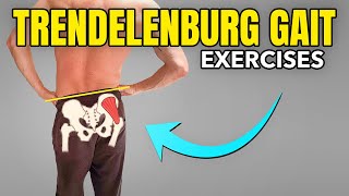 3 Exercises to Correct a Trendelenburg Gait Pattern [upl. by Dagney85]