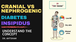 Diabetes Insipidus Cranial vs Nephrogenic DI  Super easy [upl. by Vanny747]