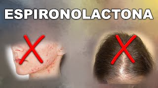 ESPIRONOLACTONA ¿solución ACNÉ y ALOPECIA femenina [upl. by Damal]