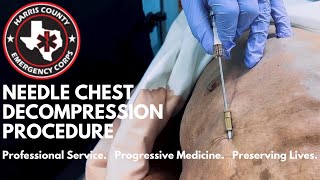 Needle Thoracostomy Needle Chest Decompression Procedure for Tension Pneumothorax [upl. by Eidlog]