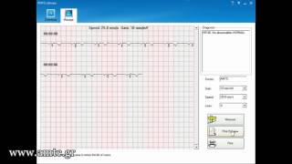 Contec PM10 software [upl. by Koffman349]