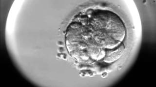 Timelapse of fertilisation of a human egg under the microscope [upl. by Semadar]