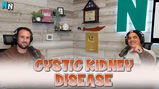 Cystic Kidney Disease  Podcast [upl. by Aicirtac]